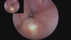 post bulking internal image.